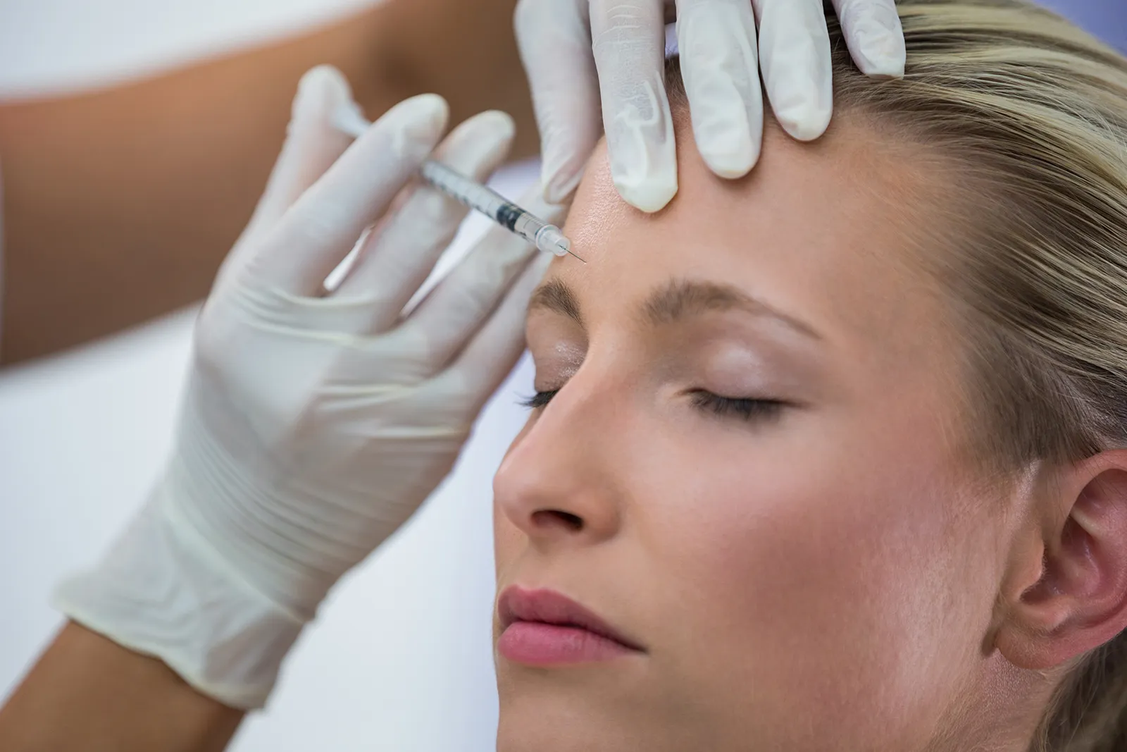 Risultati post tossina botulinica